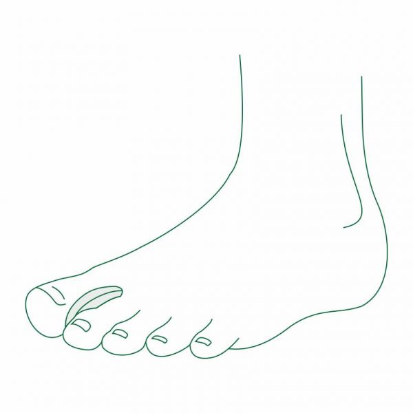 Межпальцевая перегородка силикон. sp-i-911 l (Special protectors co.ltd)