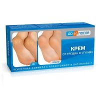 До и после крем для ног от трещин в ступнях 50мл (ТВИНС ТЭК)