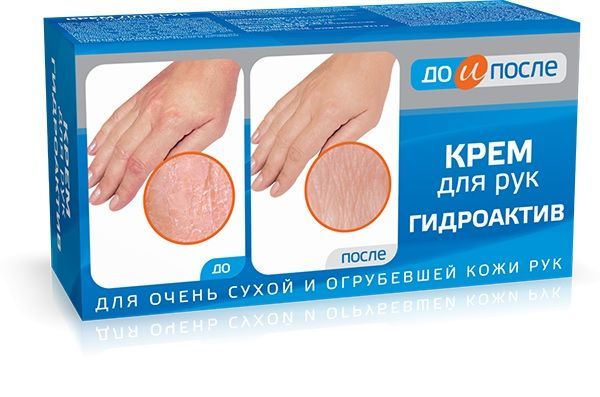 До и после гидроактив крем для сухой кожи рук 100мл (Твинс тэк ао)