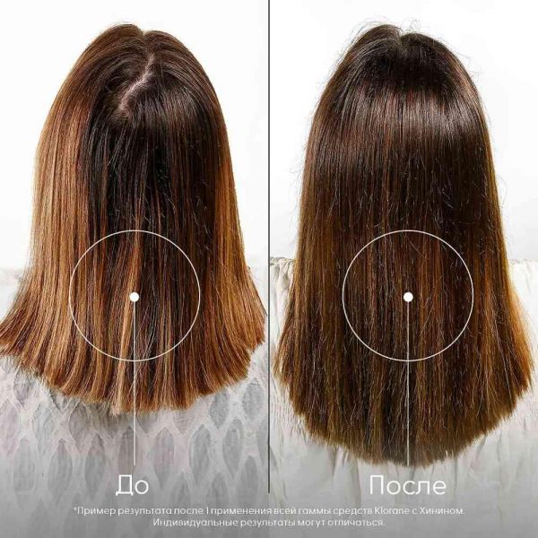 Klorane (Клоран) шампунь с экстрактом хинина 400мл (Pierre fabre dermo-cosmetique)