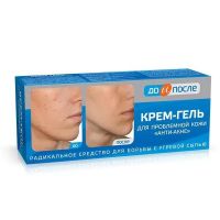 До и после анти-акне крем-гель для проблемной кожи 50мл (ТВИНС ТЭК)