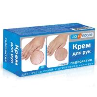 До и после гидроактив крем для сухой кожи рук 100мл (ТВИНС ТЭК)