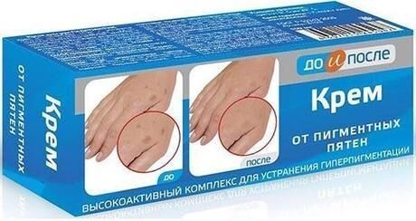 До и после крем от пигментных пятен 50мл (Твинс тэк ао)